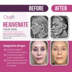 Basic: Unlock a Fabulous More Youthful You with Oralift's Patented Natural Beauty Device. Transform Your Appearance Naturally by Wearing This Innovative Mouthguard Like Device. by ORALIFT
